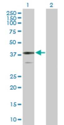 Western Blot: BDH1 Antibody [H00000622-D01P]