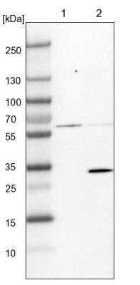 Western Blot: BDH1 Antibody [NBP1-88673]