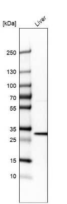 Western Blot: BDH1 Antibody [NBP1-88673]