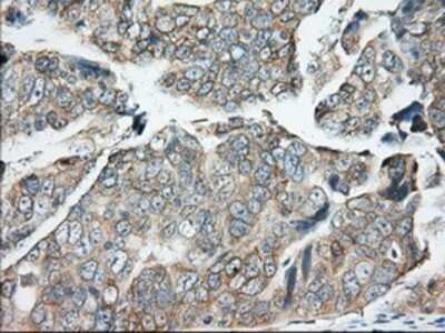 Immunohistochemistry-Paraffin: BDH2 Antibody (OTI2G1) [NBP2-02651]