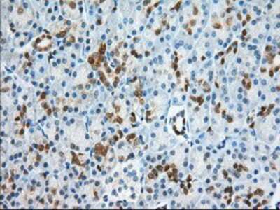 Immunohistochemistry-Paraffin: BDH2 Antibody (OTI2G1) [NBP2-02651]