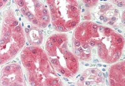 Immunohistochemistry-Paraffin: BDH2 Antibody [NB100-93379]