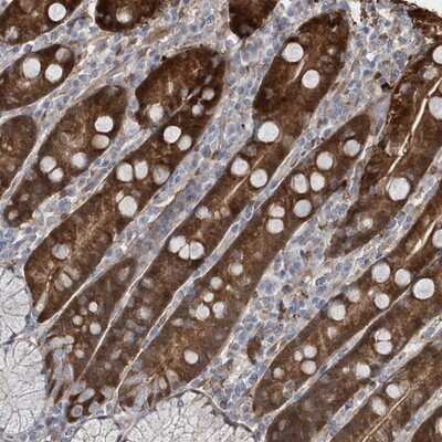 Immunohistochemistry-Paraffin: BDH2 Antibody [NBP1-85218]