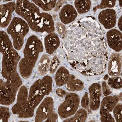 Immunohistochemistry-Paraffin: BDH2 Antibody [NBP1-85218]