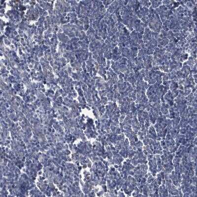 Immunohistochemistry-Paraffin: BDH2 Antibody [NBP2-32713]