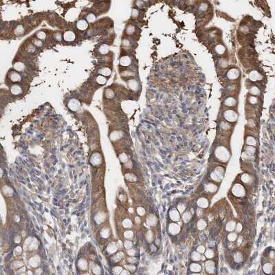 Immunohistochemistry-Paraffin: BDH2 Antibody [NBP2-32713]