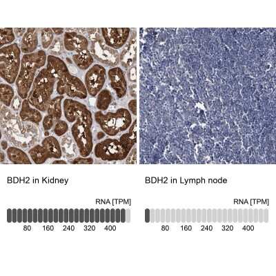 Immunohistochemistry-Paraffin: BDH2 Antibody [NBP2-32713]