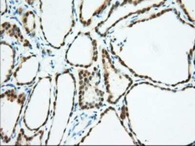 Immunohistochemistry: BDH2 Antibody (OTI2G1) - Azide and BSA Free [NBP2-72067]