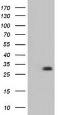 Western Blot: BDH2 Antibody (OTI2G1)Azide and BSA Free [NBP2-72067]