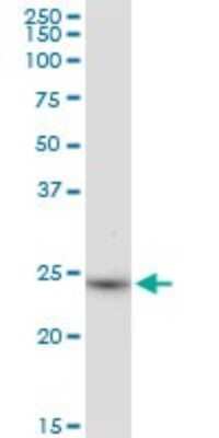 Western Blot: BDH2 Antibody [H00056898-B01P]