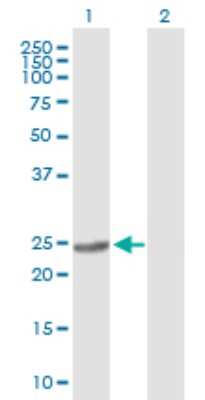 Western Blot: BDH2 Antibody [H00056898-B01P]