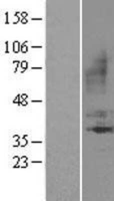 Western Blot: Bradykinin RB1/BDKRB1 Overexpression Lysate [NBL1-07959]