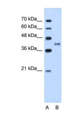 Western Blot: Bradykinin RB2/BDKRB2 Antibody [NBP1-59044]