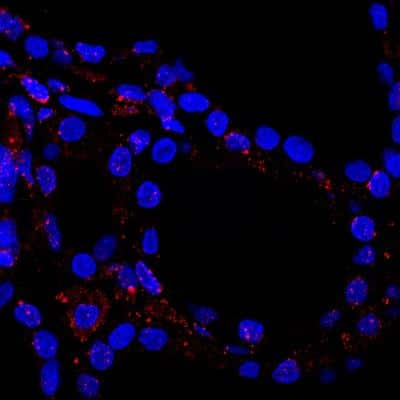 Immunocytochemistry/ Immunofluorescence: BDNF Antibody (35928.11) [NB120-10505]