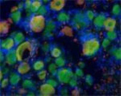 Immunohistochemistry: BDNF Antibody - Azide and BSA Free [NB100-98683]