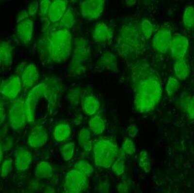 Immunohistochemistry: BDNF Antibody - Azide and BSA Free [NB100-98683]