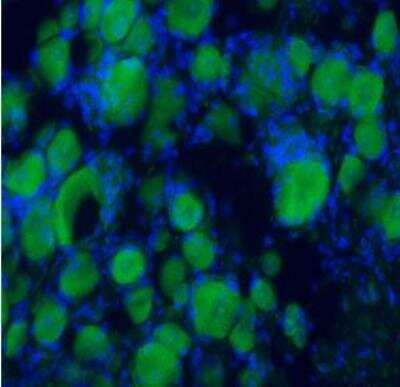 Immunohistochemistry: BDNF Antibody - Azide and BSA Free [NB100-98683]