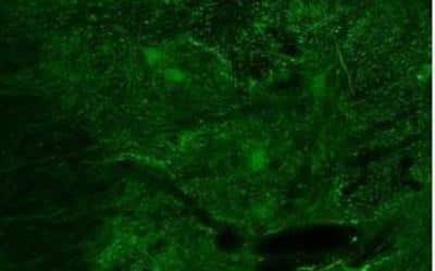 Immunohistochemistry: BDNF Antibody [NBP1-59304]