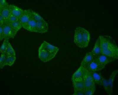 Immunocytochemistry/ Immunofluorescence: BDNF Antibody (SJ12-09) [NBP2-67410]