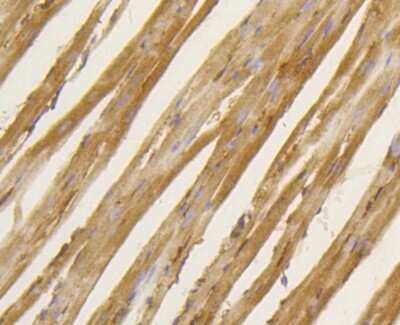 Immunohistochemistry-Paraffin: BDNF Antibody (SJ12-09) [NBP2-67410]