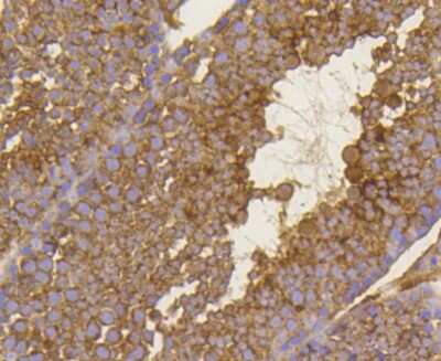 Immunohistochemistry-Paraffin: BDNF Antibody (SJ12-09) [NBP2-67410]