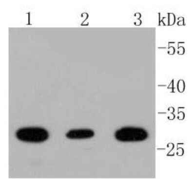 Western Blot: BDNF Antibody (SJ12-09) [NBP2-67410]