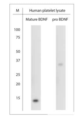 Western Blot: BDNF Antibody [NBP1-46750]