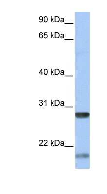 Western Blot: BDNF Antibody [NBP1-59304]