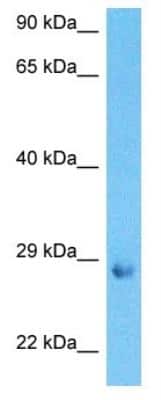 Western Blot: BDNF Antibody [NBP1-59304]