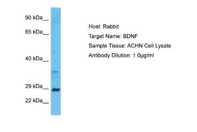Western Blot: BDNF Antibody [NBP1-59304]