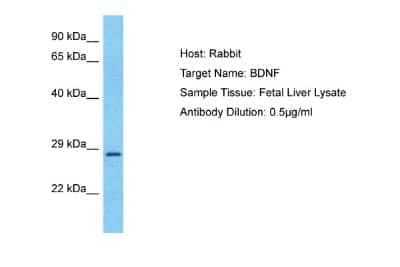 Western Blot: BDNF Antibody [NBP1-59304]