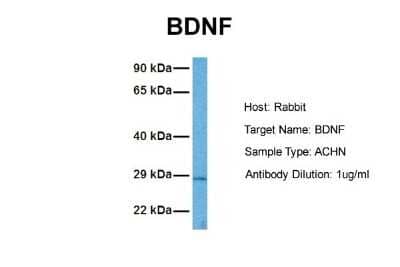 Western Blot: BDNF Antibody [NBP1-59304]