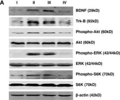 Western Blot: BDNF Antibody [NBP1-59304]