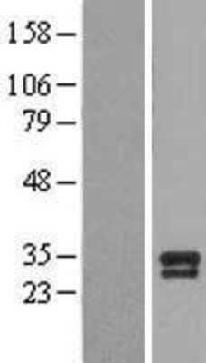 Western Blot: BDNF Overexpression Lysate [NBL1-07962]