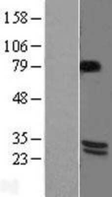 Western Blot: BDNF Overexpression Lysate [NBL1-07965]