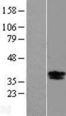 Western Blot: BDNF Overexpression Lysate [NBP2-05166]