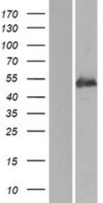 Western Blot: BDP1 Overexpression Lysate [NBP2-10325]