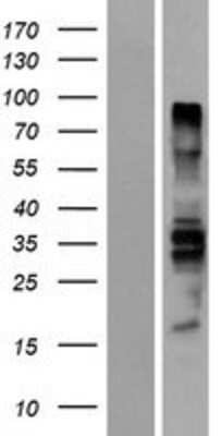 Western Blot: BDP1 Overexpression Lysate [NBP2-11070]