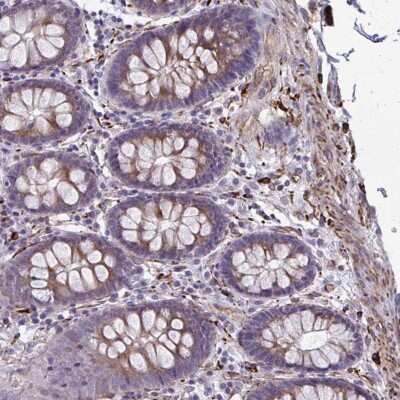 Immunohistochemistry: BEN Domain Containing 5 Antibody [NBP2-31701]