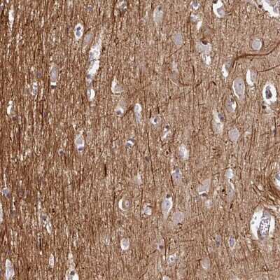 Immunohistochemistry-Paraffin: BEN Domain Containing 5 Antibody [NBP2-31576]