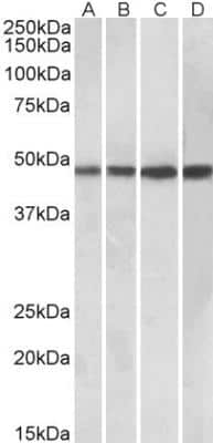 Western Blot: BEN Domain Containing 5 Antibody [NBP2-26211]