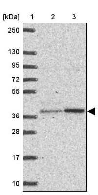 Western Blot: BEN Domain Containing 5 Antibody [NBP2-31576]