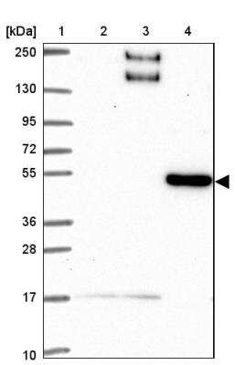 Western Blot: BEN Domain Containing 5 Antibody [NBP2-31701]