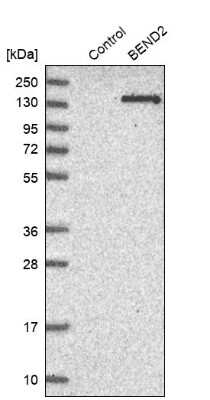 Western Blot: BEND2 Antibody [NBP1-85372]