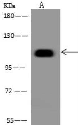 Western Blot: BEND3 Antibody [NBP3-12571]