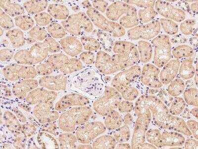 Immunohistochemistry-Paraffin: BEND7 Antibody [NBP3-06262]