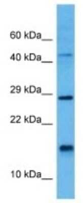 Western Blot: BET1 Antibody [NBP3-10803]