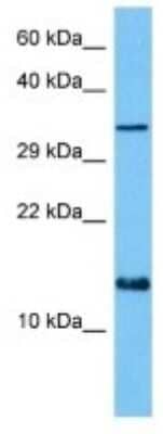 Western Blot: BET1 Antibody [NBP3-10821]