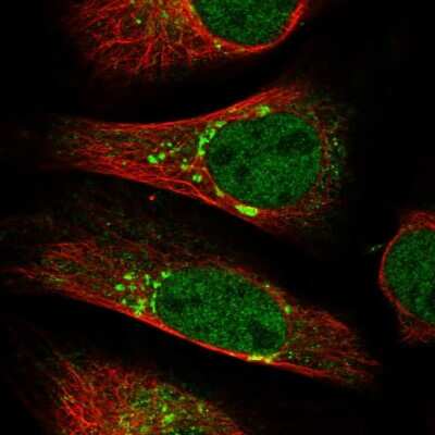 Immunocytochemistry/ Immunofluorescence: BET1L Antibody [NBP1-93714]