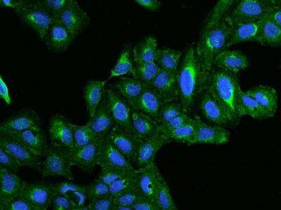 Immunocytochemistry/ Immunofluorescence: BET1L Antibody [NBP3-05961]